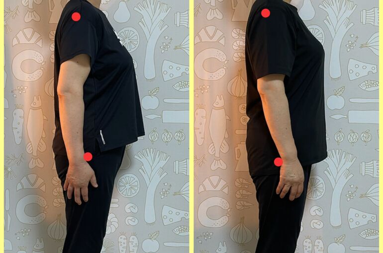 姿勢美人矯正のbeforeafter
